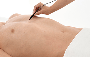 {体全身から選べる脱毛}